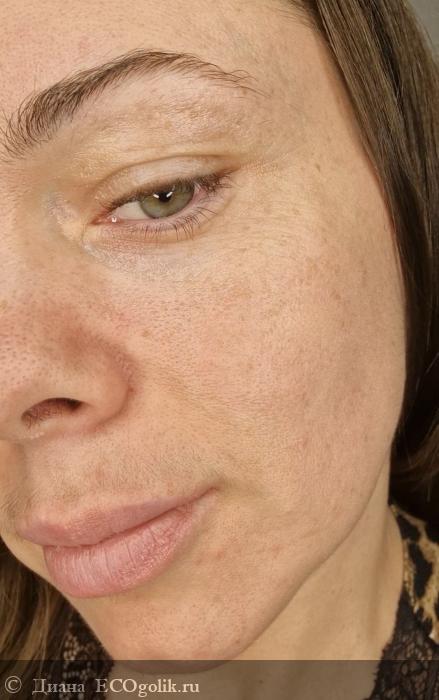 Фото «после» применения БИОкрема для кожи вокруг глаз